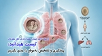 کیست هیداتید را با پیشگیری و تشخیص به‌موقع جدی بگیریم